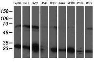 Image no. 4 for anti-phosphoglycerate Mutase 2 (Muscle) (PGAM2) antibody (ABIN1500173)