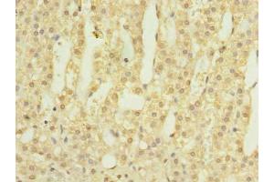 LOH12CR1 antibody  (AA 1-196)