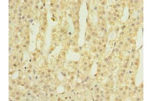 Immunohistochemistry of paraffin-embedded human adrenal gland tissue using ABIN7145628 at dilution of 1:100 (LOH12CR1 antibody  (AA 1-196))