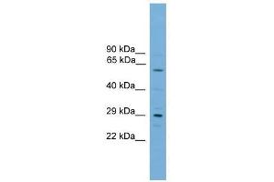 Western Blot showing RPAIN antibody used at a concentration of 1-2 ug/ml to detect its target protein. (RPAIN antibody  (C-Term))