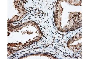 Immunohistochemical staining of paraffin-embedded liver tissue using anti-APP mouse monoclonal antibody. (APP antibody)
