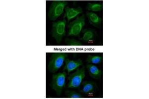 ICC/IF Image Immunofluorescence analysis of paraformaldehyde-fixed HeLa, using CCN3 , antibody at 1:200 dilution. (NOV antibody  (Center))