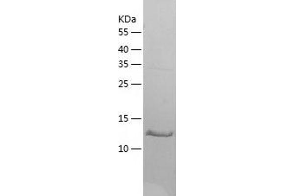 EIF5A2 Protein (AA 1-153) (His tag)