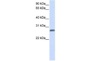 TMEM51 antibody used at 1 ug/ml to detect target protein. (TMEM51 antibody  (N-Term))