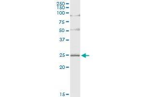 Immunoprecipitation of ARL4D transfected lysate using anti-ARL4D MaxPab rabbit polyclonal antibody and Protein A Magnetic Bead , and immunoblotted with ARL4D MaxPab mouse polyclonal antibody (B01) . (ARL4D antibody  (AA 1-201))