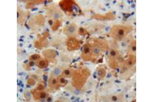 Used in DAB staining on fromalin fixed paraffin-embedded Liver tissue (IGF1 antibody  (AA 48-118))