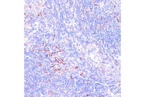 Immunohistochemistry of paraffin-embedded mouse spleen using Zyxinin antibody (ABIN3023008, ABIN3023009, ABIN3023010 and ABIN6219343) at dilution of 1:100 (40x lens). (ZYX antibody  (AA 1-300))