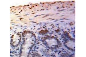 Used in DAB staining on fromalin fixed paraffin-embedded Bowels tissue (PML antibody  (AA 59-239))