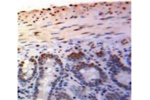 Used in DAB staining on fromalin fixed paraffin-embedded Bowels tissue (PML antibody  (AA 59-239))