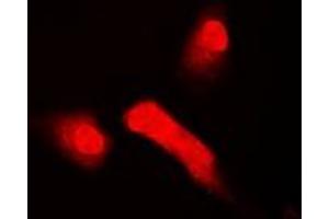 Immunofluorescent analysis of HOS staining in A549 cells. (T-Box 5 antibody)