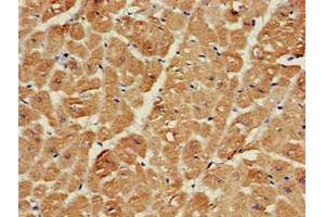 Immunohistochemistry of paraffin-embedded human heart tissue using ABIN7168941 at dilution of 1:100 (SRR antibody  (AA 1-340))