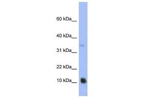 MGC70863 antibody used at 1 ug/ml to detect target protein. (MGC70863 antibody  (N-Term))