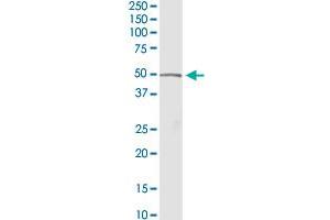 ACADM MaxPab rabbit polyclonal antibody. (Medium-Chain Specific Acyl-CoA Dehydrogenase, Mitochondrial (MCAD) (AA 1-421) antibody)