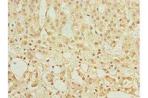 Immunohistochemistry of paraffin-embedded human adrenal gland tissue using ABIN7154963 at dilution of 1:100 (HEMK1 antibody  (AA 1-338))