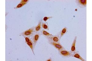 Immunocytochemistry analysis of Hela cells using ABIN7139162 at dilution of 1:100 (HIST1H1C antibody  (acLys16))