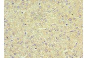 Immunohistochemistry of paraffin-embedded human liver tissue using ABIN7170334 at dilution of 1:100 (SRI antibody  (AA 1-198))