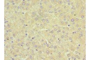 Immunohistochemistry of paraffin-embedded human liver tissue using ABIN7170334 at dilution of 1:100