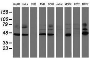 Image no. 1 for anti-serpin Peptidase Inhibitor, Clade B (Ovalbumin), Member 1 (SERPINB1) (AA 77-306) antibody (ABIN1491673) (SERPINB1 antibody  (AA 77-306))