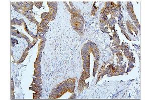 IHC analysis of BubR1/BUB1B using anti-BubR1/BUB1B antibody (ABIN7600962).