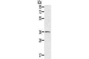 Western Blotting (WB) image for anti-Ring Finger Protein 144B (RNF144B) antibody (ABIN2430277) (RNF144B antibody)