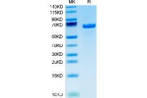 Human DLL1/Delta1 on Tris-Bis PAGE under reduced condition. (DLL1 Protein (AA 18-540) (His tag))