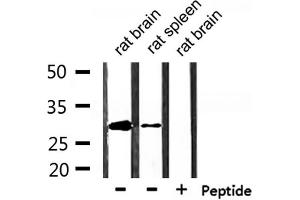 Western blot analysis of extracts from rat brain and rat spleen, using Hes1 Antibody.