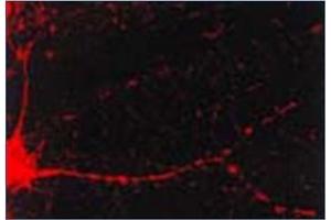Immunofluorescence (IF) image for anti-Calcium/calmodulin-Dependent Protein Kinase II alpha (CAMK2A) antibody (ABIN492419) (CAMK2A antibody)