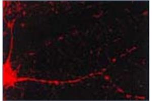 Immunofluorescence (IF) image for anti-Calcium/calmodulin-Dependent Protein Kinase II alpha (CAMK2A) antibody (ABIN492419)