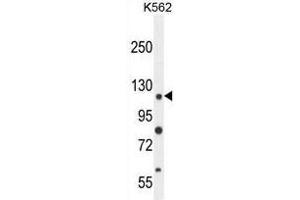 ANR52 Antibody (N-term) western blot analysis in K562 cell line lysates (35µg/lane). (ANKRD52 antibody  (N-Term))