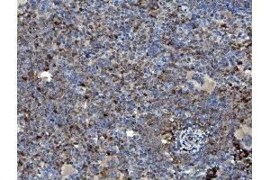 IHC analysis of GRB10 using anti-GRB10 antibody (ABIN7599204).