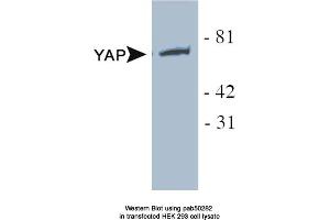 Image no. 1 for anti-Yes-Associated Protein 1 (YAP1) antibody (ABIN363591) (YAP1 antibody)