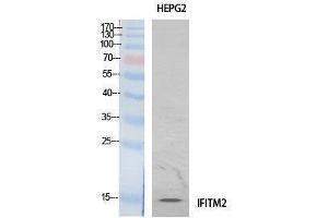 Western Blotting (WB) image for anti-Interferon Induced Transmembrane Protein 2 (IFITM2) (Internal Region) antibody (ABIN3187997)