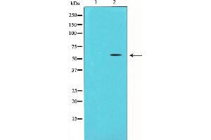 Western blot analysis of Chk1 expression in HeLa whole cell lysates,The lane on the left is treated with the antigen-specific peptide.