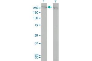 Western Blot analysis of CHD4 expression in transfected 293T cell line by CHD4 monoclonal antibody (M01A), clone 4H4. (CHD4 antibody  (AA 1632-1730))