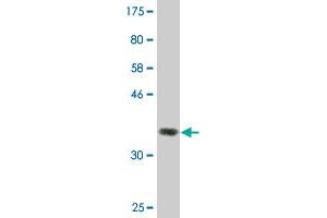 Western Blot detection against Immunogen (36. (ZFYVE16 antibody  (AA 1-100))