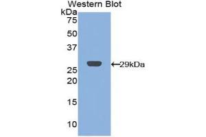 Detection of Recombinant CRP,Cavia using Polyclonal Antibody to C Reactive Protein (CRP) (CRP antibody  (AA 20-225))