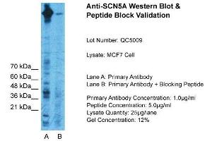 Host:  Rabbit  Target Name:  SCN5A  Sample Type:  MCF7 Whole Cell  Lane A:  Primary Antibody  Lane B:  Primary Antibody + Blocking Peptide  Primary Antibody Concentration:  1ug/ml  Peptide Concentration:  5ug/ml  Lysate Quantity:  25ug/lane/Lane  Gel Concentration:  0. (SCN5A antibody  (C-Term))