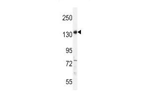 PALB2 antibody  (AA 546-574)