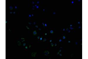 ImmunofluorescencestainingofPC3cellswithABIN7162195at1:100,counter-stainedwithDAPI. (OR9G1 antibody  (AA 290-304))