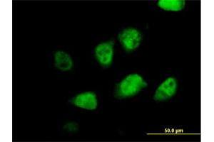 Immunofluorescence of purified MaxPab antibody to MLF2 on HeLa cell. (MLF2 antibody  (AA 1-248))