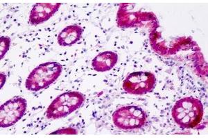 anti-GIPC PDZ Domain Containing Family, Member 1 (GIPC1) antibody