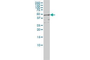 RIOK3 monoclonal antibody (M01), clone 4A12-1D2 Western Blot analysis of RIOK3 expression in Hela S3 NE ( Cat # L013V3 ). (RIOK3 antibody  (AA 1-516))