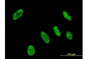 Immunofluorescence of monoclonal antibody to NEUROG3 on HeLa cell. (Neurogenin 3 antibody  (AA 1-101))