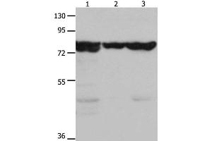Western Blot analysis of Mouse kidney tissue, 293T and hela cell using HSP75 Polyclonal Antibody at dilution of 1:1500 (TRAP1 antibody)