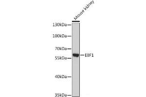 Western blot analysis of extracts of Mouse kidney using EBF1 Polyclonal Antibody at dilution of 1:1000. (EBF1 antibody)
