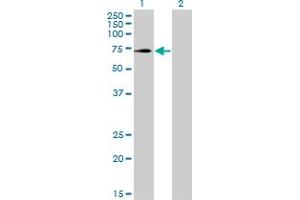 Western Blot analysis of TRIM32 expression in transfected 293T cell line by TRIM32 monoclonal antibody (M09), clone 2E5. (TRIM32 antibody  (AA 105-204))
