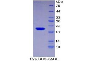 SDS-PAGE (SDS) image for Centromere Protein E, 312kDa (CENPE) (AA 2450-2590) protein (His tag) (ABIN2124288) (CENPE Protein (AA 2450-2590) (His tag))