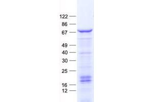 Validation with Western Blot (FOXC2 Protein (His tag))