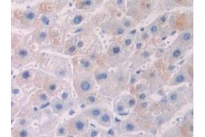 Detection of OTUB1 in Human Liver Tissue using Polyclonal Antibody to Otubain 1 (OTUB1) (OTUB1 antibody  (AA 1-271))