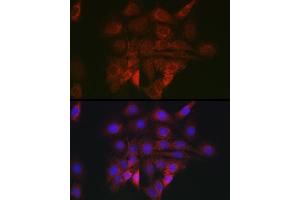 Immunofluorescence analysis of PC-12 cells using BiP/GRP78 Rabbit pAb (ABIN6134514, ABIN6142042, ABIN6142044 and ABIN6215180) at dilution of 1:100 (40x lens). (GRP78 antibody  (AA 550-650))